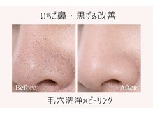 プロット 大阪本店(plot)の雰囲気(毛穴洗浄×ムルトクスで乾燥対策&黒ずみ改善◎)