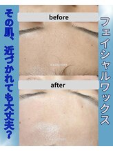 ビー ファクトリー(B FACTORY)/フェイシャルワックス