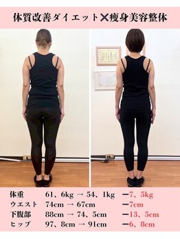 恵整骨院/30代 3ヵ月ダイエット成果