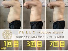 ペリー(PELLY)/男性40代　before after