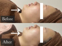 ベルフィーヌ 恵比寿店(BELFINE)/あなたも理想の横顔美人に！