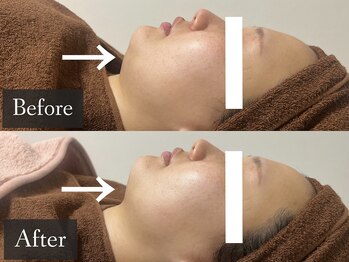 ベルフィーヌ 恵比寿店(BELFINE)/あなたも理想の横顔美人に!