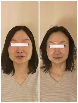 アンドアドレ(&adorer)/一回でこの変化!