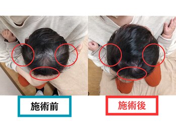 バランスアップラボ(バランスアップLAB)/★赤ちゃん整体　Before＆After1