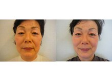 小顔矯正 イザト整体院(IZATO)/