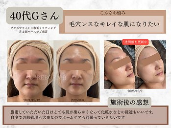 リボーン 柏(REBORN)/毛穴ケア対応も対応可能です!