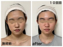 ダルセーニョ/「自分への投資」に年齢は無関係