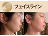 【人気No.1フェイスラインもたつきに】たるみ改善×小顔かっさ×首肩スッキリ