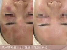 サロン ド ボーテ シャルル(Chaleureux)の雰囲気（インナーカウンセリング有）