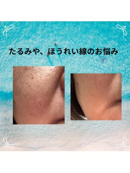 ルアナ(Luana)の写真/毎日頑張る貴女への大切な時間！９８％が眠る極上の手技でドライヘッド／フェイシャルケアでゆっくりと♪
