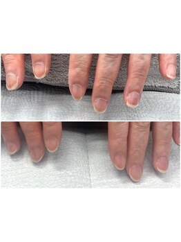 爪の悩みを解消できる（ケア含む）