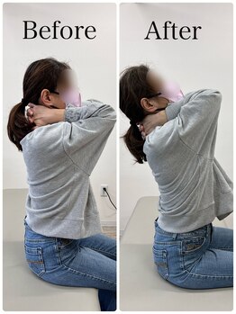 まこと整体院 新鳥栖店/ビフォーアフター（首、肩こり）