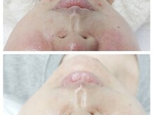 クリアー(CLEAR.)/【Before＆After】