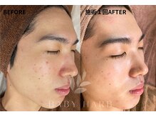 フィズ 新越谷店(FIS)の雰囲気（話題のハーブピーリングで美肌に◎完全個室でリラックス♪[小顔]）