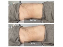 パシト(pasito)の雰囲気(腸もみ//便秘/下痢/ぽっこり下腹/ガス溜まり/痩せ体質/肌質改善)