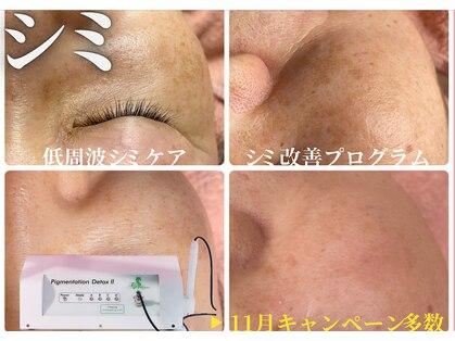 ヌー 栄(nuu)の写真