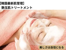 シャイニー(Shiny)