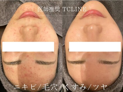 トップスキン 新宿(TOPSKIN)の写真