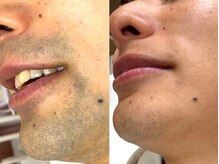 エステティック 華/