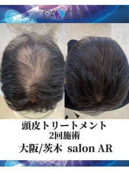 メンズサロンアール(AR)/プロセルセラピーズ