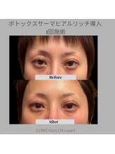 リュクシー(LuxeY)/40代　脂肪増減で若見え