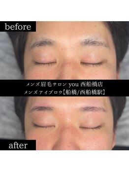 ユー 西船橋店(you)/ビフォーアフター写真