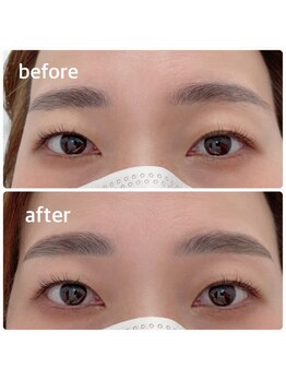 ユニゾン(Unison)/ハリウッドブロウリフト