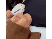 アンベリール(Embellir)/メンズ☆ヒゲ脱毛