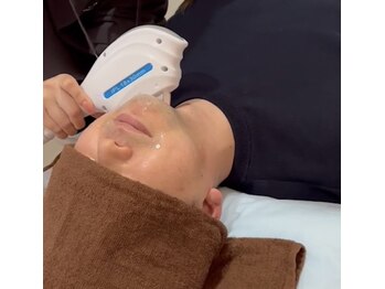 アンベリール(Embellir)/メンズ☆ヒゲ脱毛