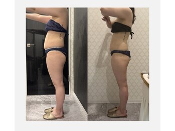 シャルム(CHARME)/産後ダイエットお任せ下さい！