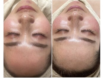 モンクラッシー(Mon classy)/