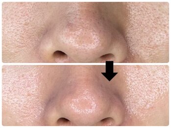 エフェクト 塚口店(effect)/before after