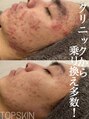 トップスキン 名駅(TOPSKIN) 一生モノの 肌を創る