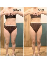 まろんのエステ/40代　痩身エステ（下半身）