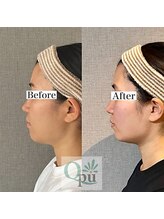 キュープ 鹿児島伊集院店(Qpu)/