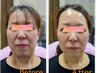 【鏡を見るのが楽しみに◎】印象改善美肌プレミアム〈集中エイジング〉