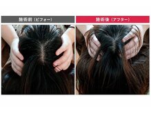 マリン/新コース