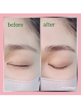 フェリーチェ(felice)/ハリウッドブロウリフト