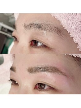 デジックスプラス(Digix+)/【眉毛】