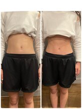 長寿鍼灸院 長寿整骨院/EMS＜お腹集中コース＞