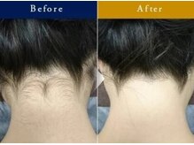 フローラル ビューティー(Floral-Beauty)の雰囲気（【パーツ脱毛も！】きちんと卒業出来る美肌脱毛）