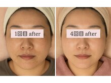 ピュルテ/サーマガン500ショット