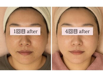 ピュルテ/サーマガン500ショット