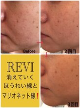 ホワイトセージ(White Sage)/ビフォーアフター1