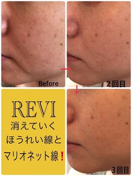 ホワイトセージ(White Sage)/ビフォーアフター1