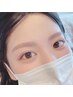 【産毛除去で透明感アップ】アイブロウケア&額WAX