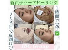 トータルサロンアイビーシー(トータルサロンIBC)/ハーブピーリングで神肌へ☆