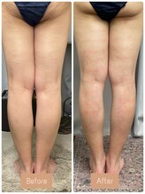 FJ/下半身集中痩身◎