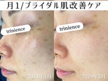 トリニエンス 新宿店(TRINIENCE)/20代/パーソナル改善ケア