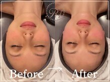 R-1ビューティーサロン 表参道/Before＆After